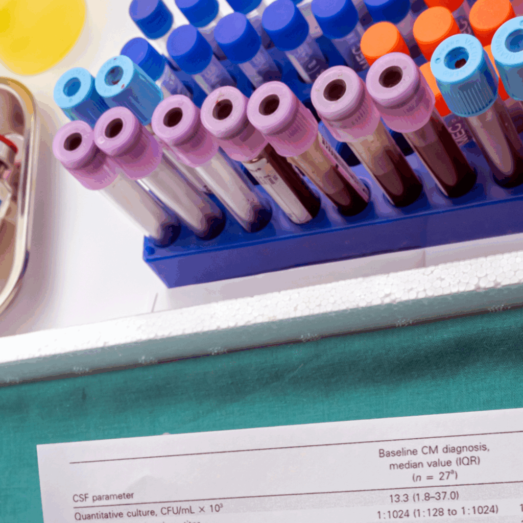 A close-up image of a laboratory setting shows a rack of blood collection tubes in the background, sorted by cap color. In the foreground, part of a printed clinical report is visible, listing cerebrospinal fluid (CSF) parameters such as “Quantitative culture” and associated median values under “Baseline CM diagnosis.”
