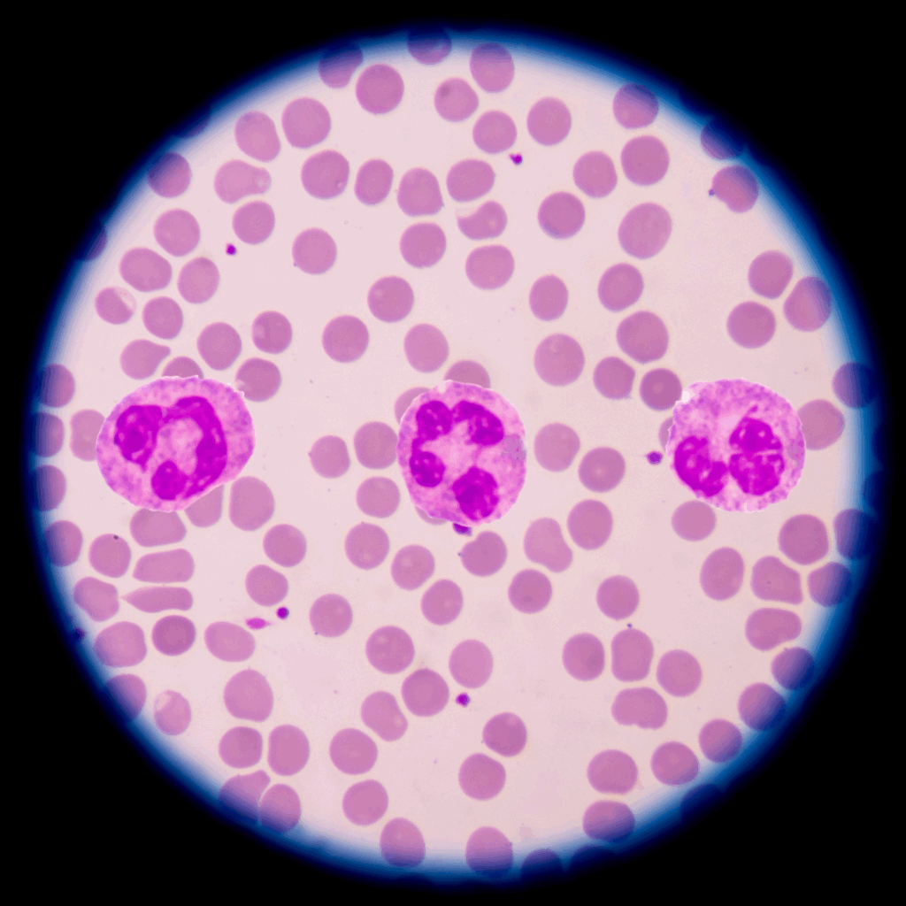 Microscopic image of blood cells showing many pink red blood cells and three larger purple-stained neutrophils with segmented nuclei.